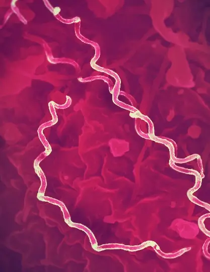 Microscopic view of two spiral-shaped bacteria, light yellow in color, set against a deep pink and red textured background. The twisted corkscrew forms evoke imagery from an operation outbreak scenario.