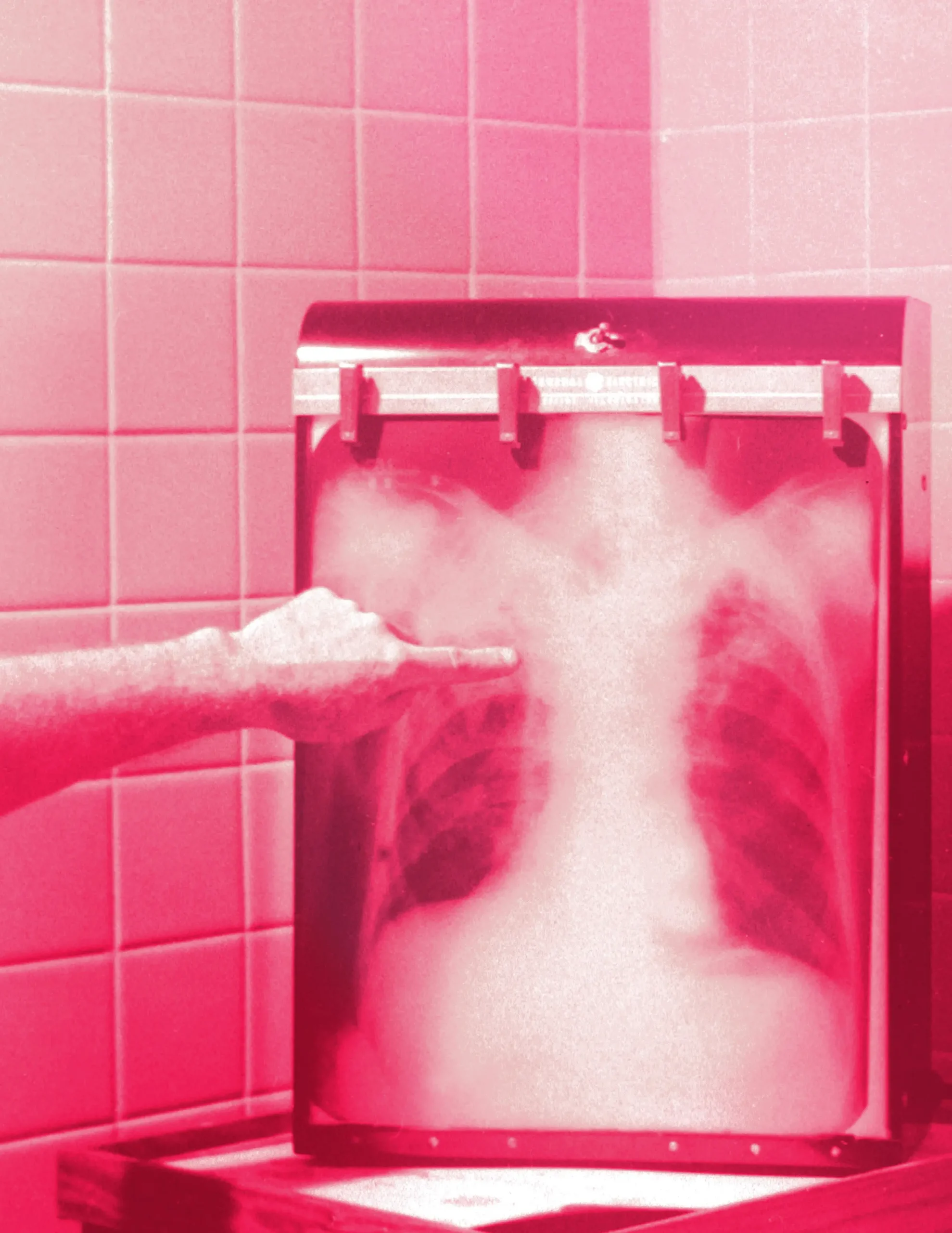A hand points to a spot on a chest X-ray on a lightbox, tinted red-pink