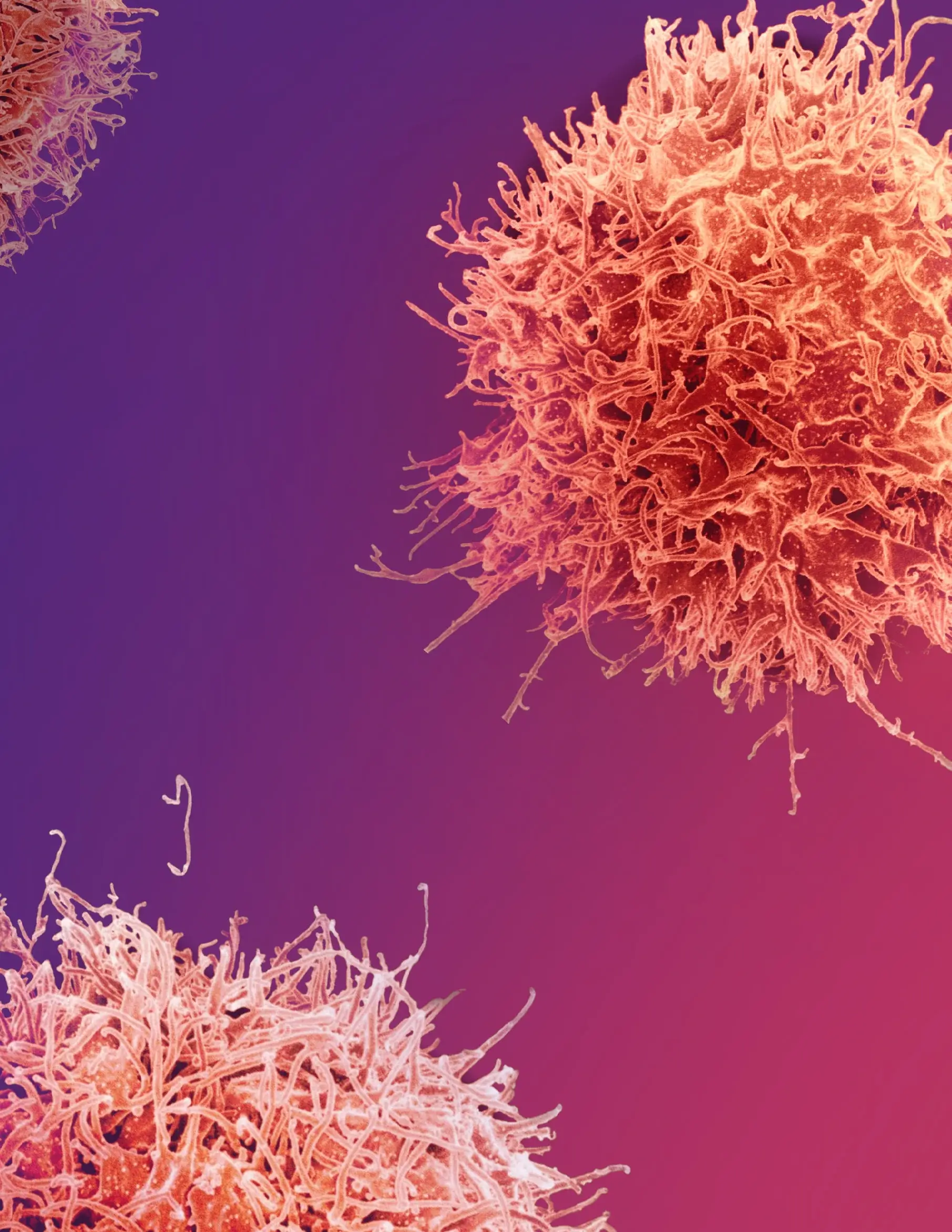 Orange and pink spherical cells with filament extensions on purple to pink